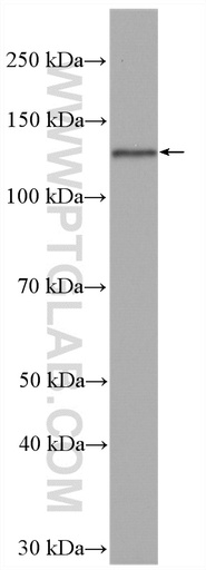 [27635-1-AP-150UL] BACH2 Polyclonal antibody