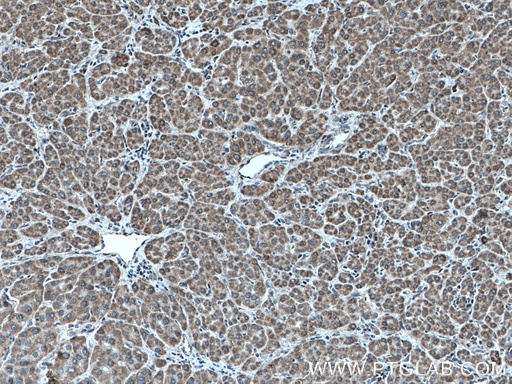 [27657-1-AP-150UL] TAPT1 Polyclonal antibody