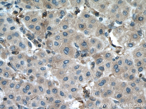 [27662-1-AP-150UL] DPYD Polyclonal antibody