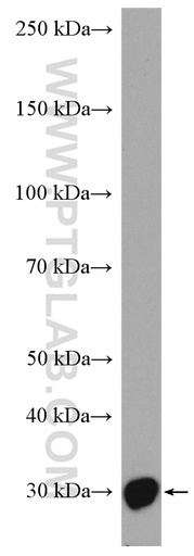 [27679-1-AP-20UL] SAP30 Polyclonal antibody