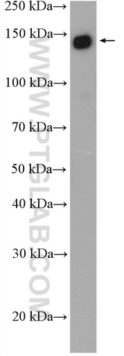 [27684-1-AP-20UL] SF3B1 Polyclonal antibody