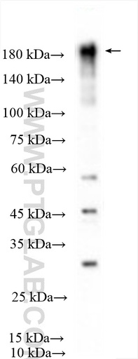 [27694-1-AP-150UL] TIAM1 Polyclonal antibody