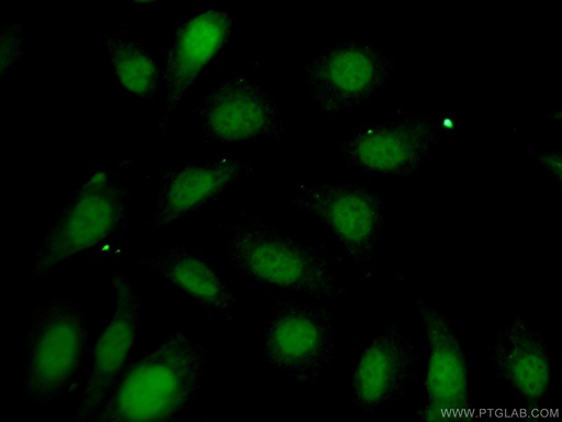 [27707-1-AP-150UL] FTSJD2 Polyclonal antibody