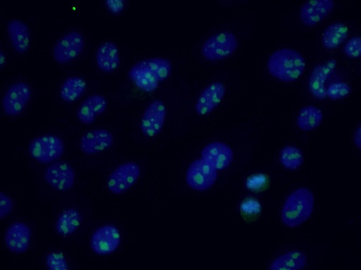 [27723-1-AP-150UL] RRP1B Polyclonal antibody