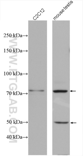[27727-1-AP-20UL] ABI3BP Polyclonal antibody