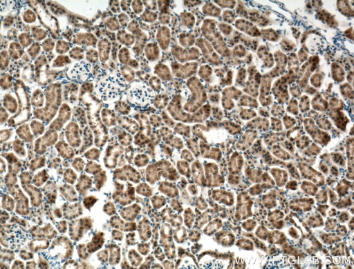 [27732-1-AP-20UL] ECHDC1 Polyclonal antibody