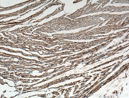 [27733-1-AP-20UL] OPA1 Polyclonal antibody