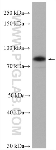 [27741-1-AP-150UL] TRAFD1 Polyclonal antibody