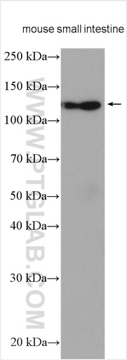 [27742-1-AP-20UL] ASAH2 Polyclonal antibody