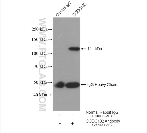 [27749-1-AP-20UL] Syndetin/CCDC132 Polyclonal antibody