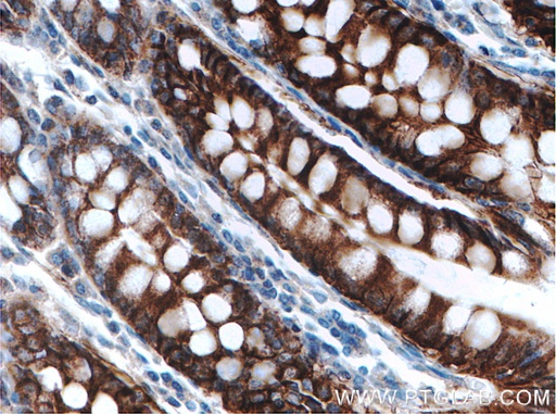 [27759-1-AP-20UL] SLC26A2 Polyclonal antibody