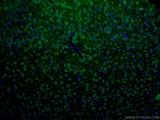 [27766-1-AP-20UL] ANK3 Polyclonal antibody