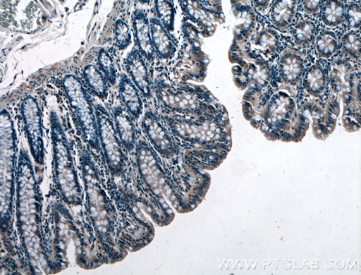 [27768-1-AP-20UL] GET4 Polyclonal antibody