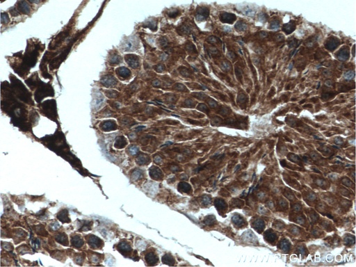 [27791-1-AP-150UL] USP8 Polyclonal antibody