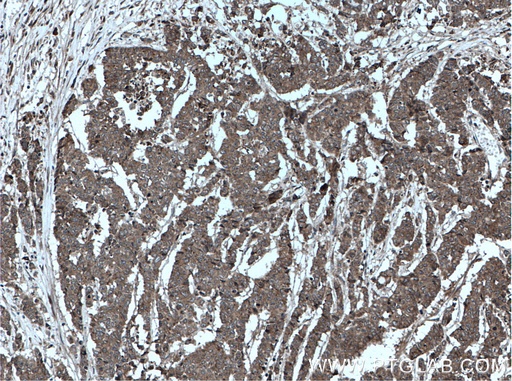 [27792-1-AP-150UL] OSM Polyclonal antibody