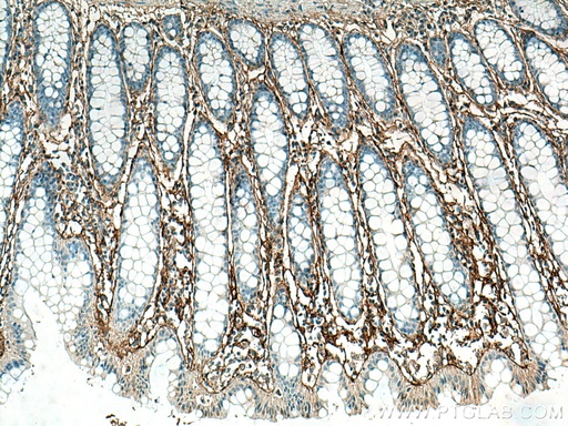 [27794-1-AP-20UL] Periostin Polyclonal antibody