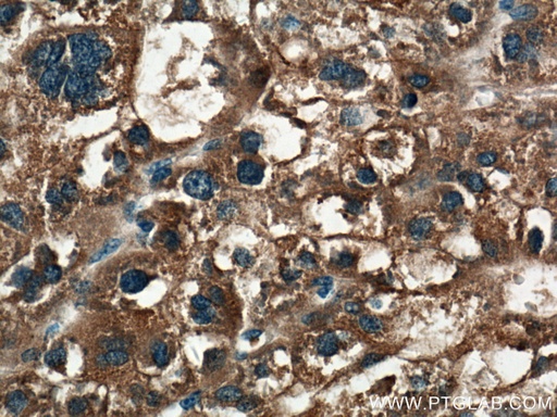 [27805-1-AP-20UL] PPP4R1 Polyclonal antibody