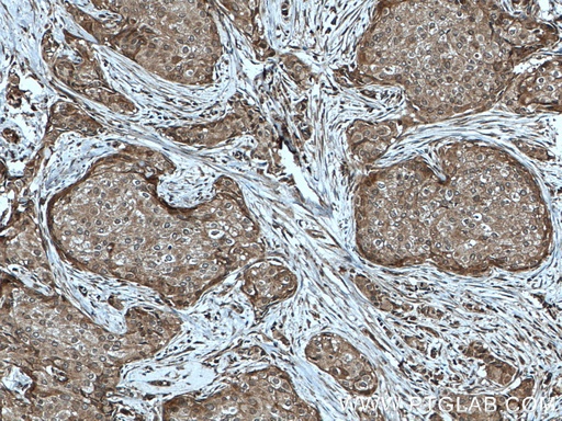 [27808-1-AP-150UL] PARG Polyclonal antibody