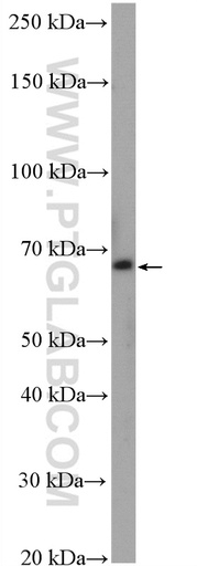 [27811-1-AP-150UL] ZNF570 Polyclonal antibody