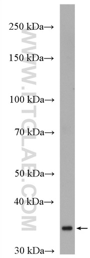 [27818-1-AP-20UL] HAPLN2 Polyclonal antibody