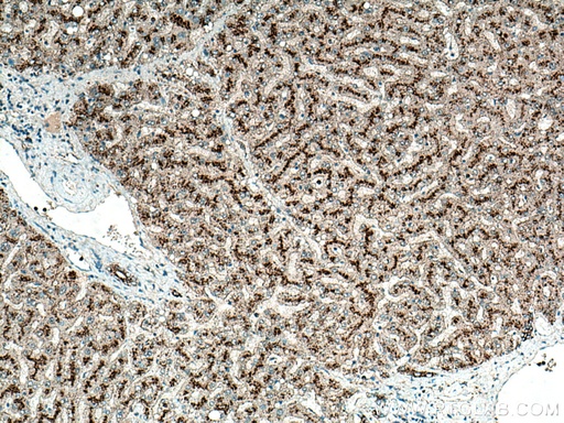 [27823-1-AP-150UL] LAMP2 Polyclonal antibody