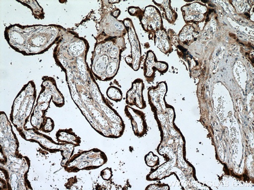 [27830-1-AP-150UL] HSD17B1 Polyclonal antibody