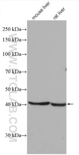 [27843-1-AP-150UL] RPUSD4 Polyclonal antibody