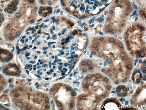 [27846-1-AP-20UL] C22orf25 Polyclonal antibody