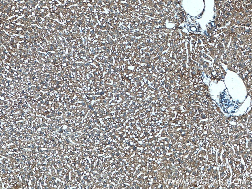 [27848-1-AP-20UL] ABCC6 Polyclonal antibody