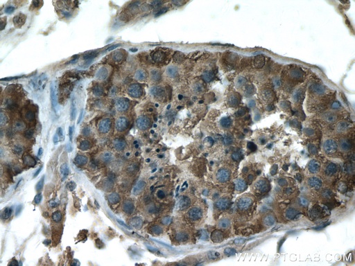[27861-1-AP-150UL] GDPD1 Polyclonal antibody