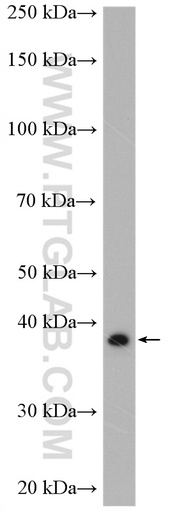 [27865-1-AP-150UL] RyDEN Polyclonal antibody