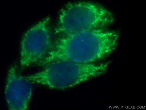 [27867-1-AP-20UL] Titin Polyclonal antibody