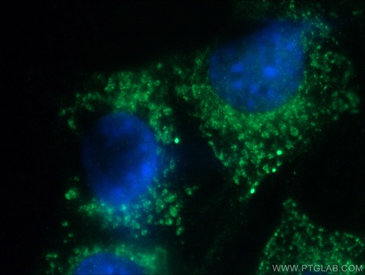[27869-1-AP-150UL] SLC25A46 Polyclonal antibody