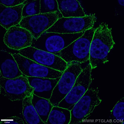 [27872-1-AP-20UL] Gamma Catenin Polyclonal antibody