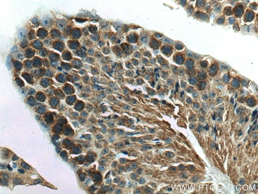 [27879-1-AP-20UL] NEU3 Polyclonal antibody