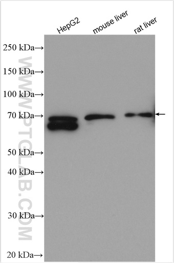 [27882-1-AP-20UL] PCSK9 Polyclonal antibody