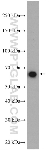 [27886-1-AP-150UL] KIAA2013 Polyclonal antibody