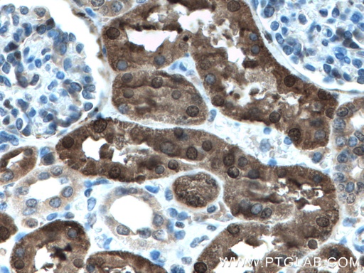 [27891-1-AP-150UL] PBLD Polyclonal antibody