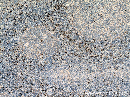 [27894-1-AP-20UL] Granzyme K Polyclonal antibody