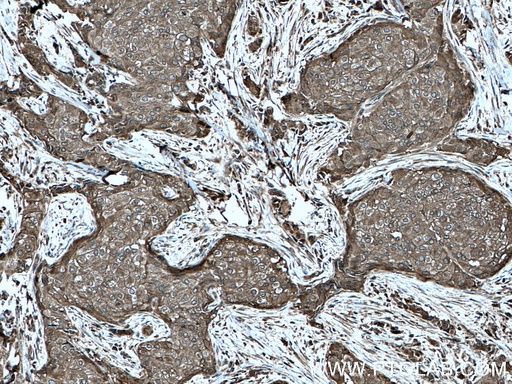 [27926-1-AP-20UL] C19orf62 Polyclonal antibody