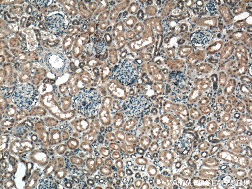 [27930-1-AP-20UL] C1orf35 Polyclonal antibody
