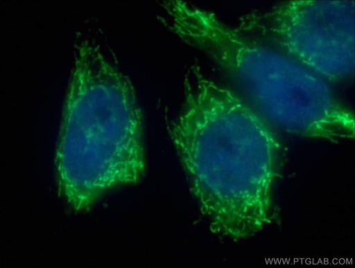 [27931-1-AP-20UL] NDUFB4 Polyclonal antibody