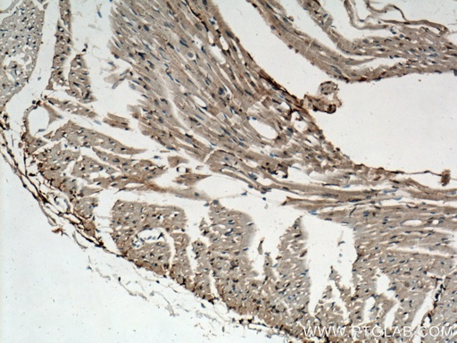 [27938-1-AP-20UL] SLC10A6 Polyclonal antibody