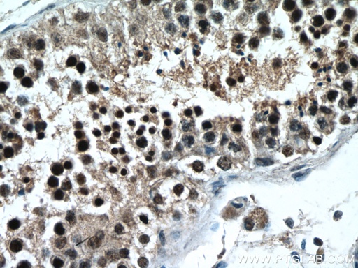 [27942-1-AP-150UL] PAK6 Polyclonal antibody