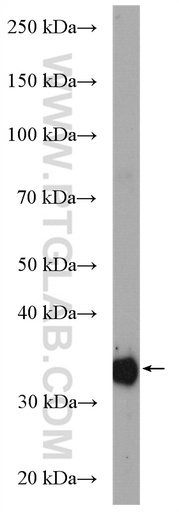 [27943-1-AP-20UL] GPD1 Polyclonal antibody