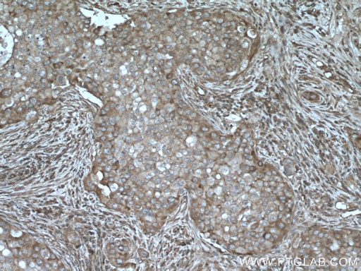 [27947-1-AP-20UL] AKAP13 Polyclonal antibody