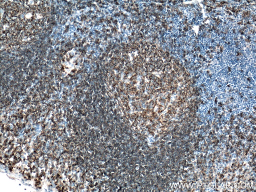 [27949-1-AP-150UL] CD19 Polyclonal antibody