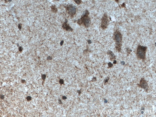 [27951-1-AP-150UL] MYCBP2 Polyclonal antibody
