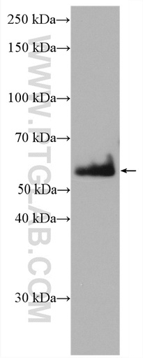 [27953-1-AP-20UL] CDSN Polyclonal antibody