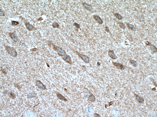 [27972-1-AP-150UL] GBA Polyclonal antibody